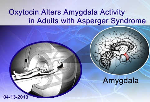 ASD-Oxytocin-AmygdalaV.1